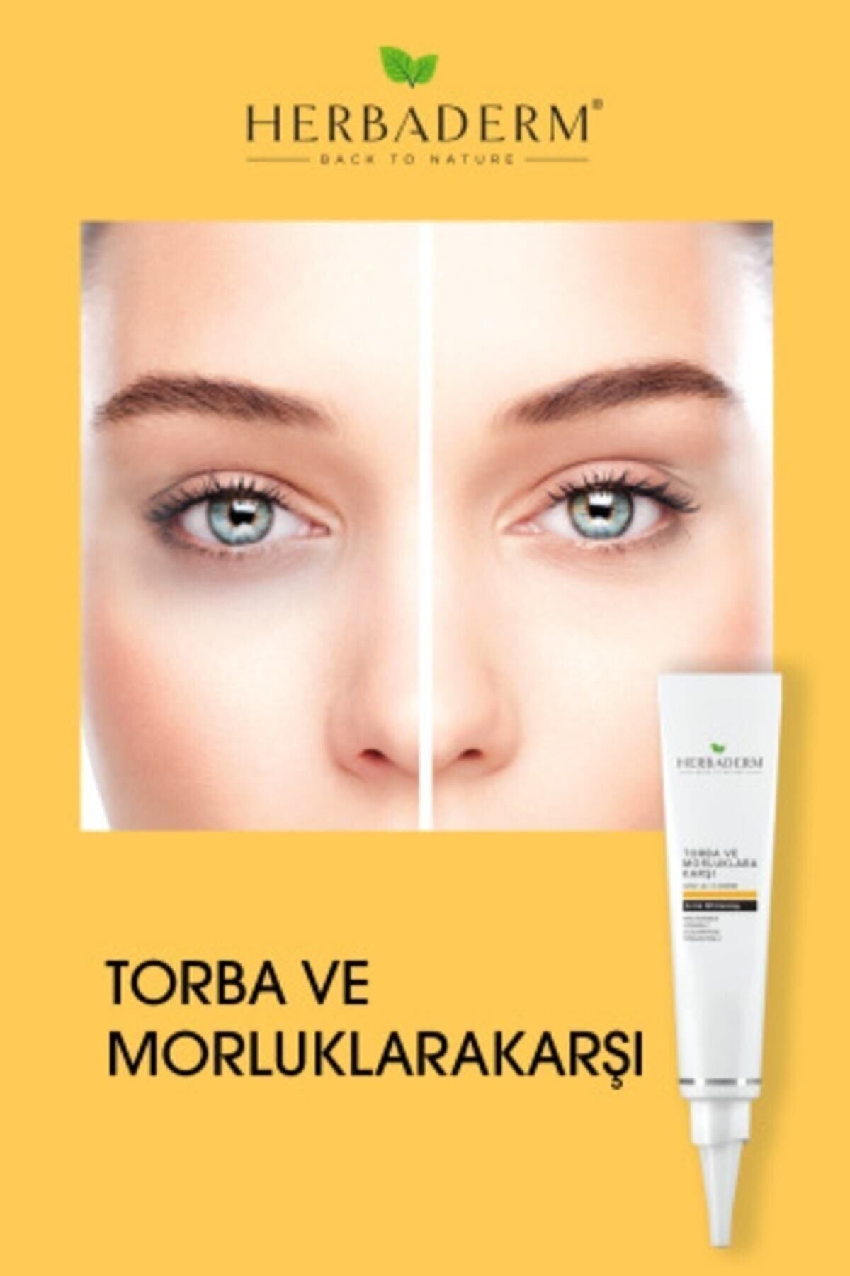 Herbaderm Torba Ve Morluklara Karşı Krem 15 Ml