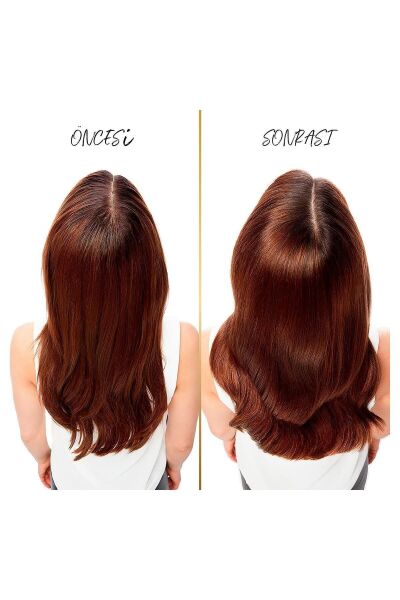 Pantene Kepeğe Karşı Etkili Şampuan 3'ü 1 Arada 400 Ml