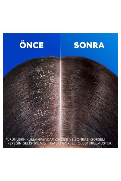 Head & Shoulders Kadınlara Özel Dökülme Karşıtı Kepeğe Karşı Etkili Şampuan 330 ml