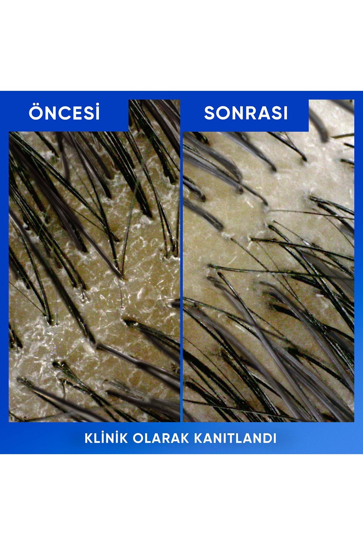 Head And Shoulders Arındırma&Parlaklık Kepeğe Karşı Etkili Şampuan 330 ml