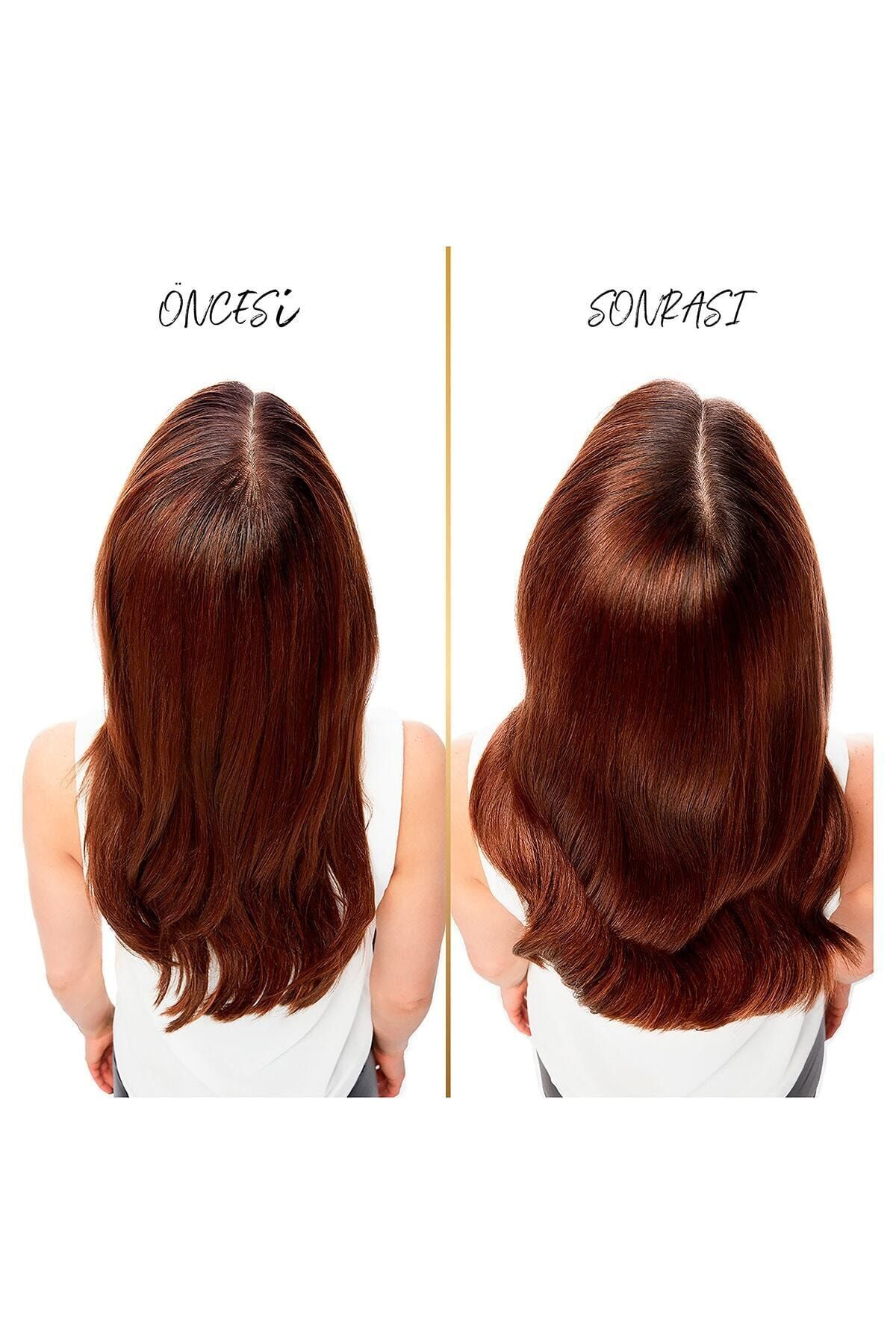 Kepeğe Karşı Etkili Şampuan 3'ü 1 Arada 400 Ml