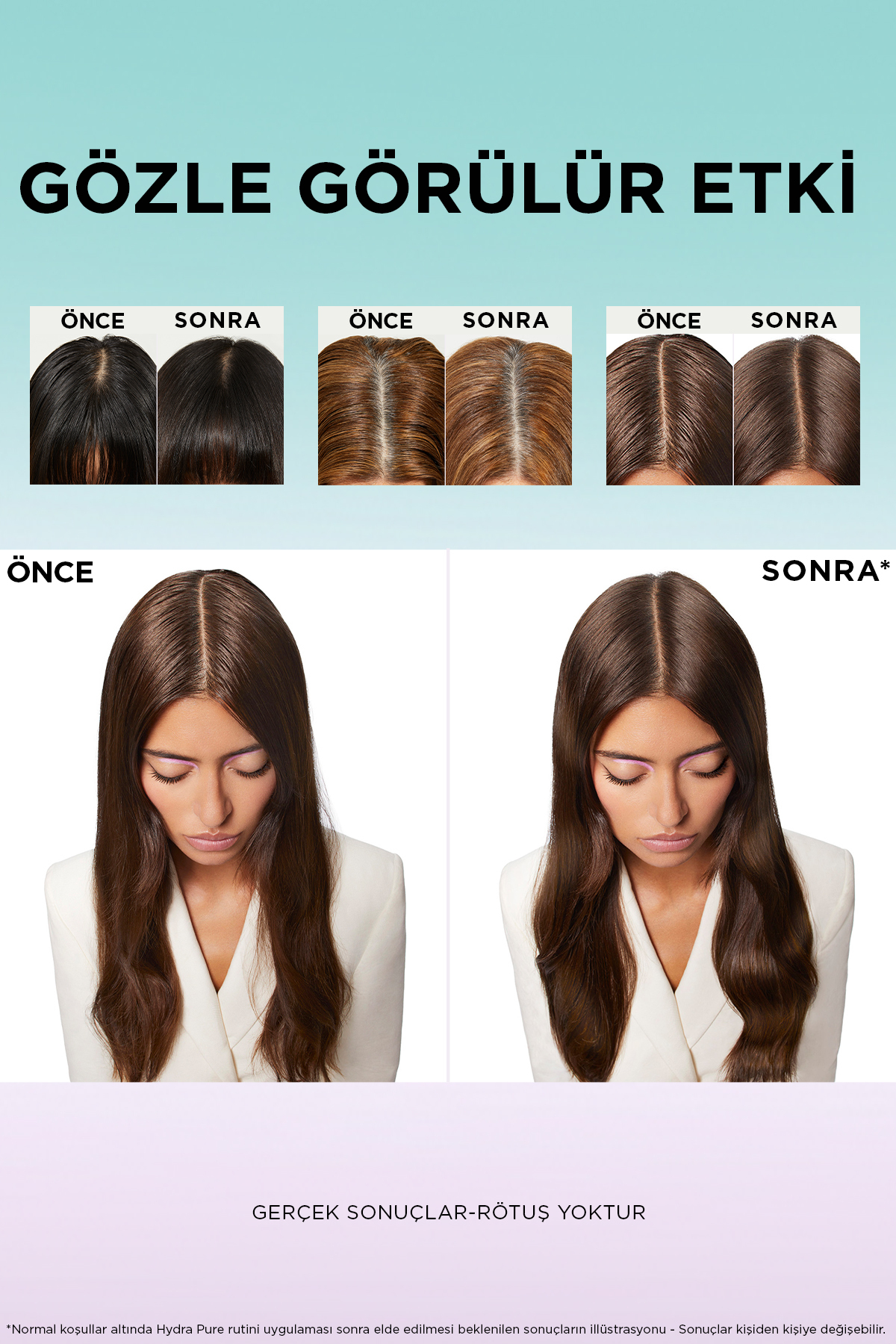 Hydra [hyaluronic] Pure Salisilik Asit Içeren Yağlanma Karşıtı Arındırıcı Şampuan 300ml